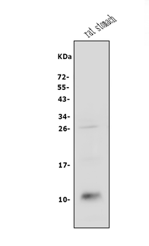Anti-CXCL12 Antibody