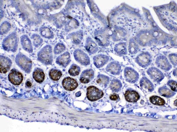 Anti-IGF1 Receptor/Igf1r Antibody
