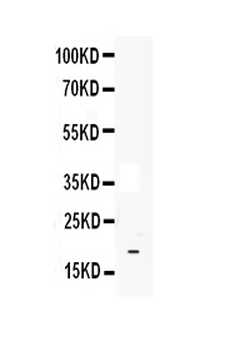 Anti-IL33 Antibody