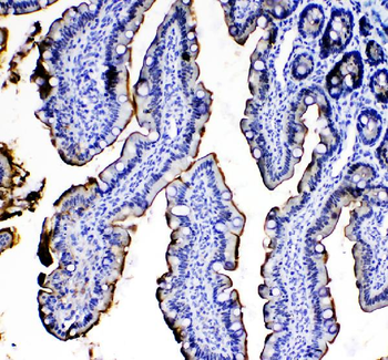 Anti-IL33 Antibody