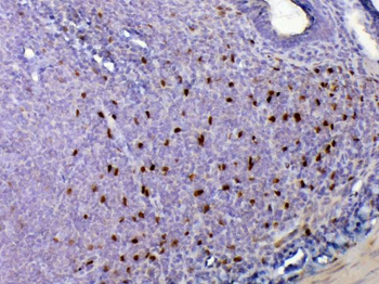 Anti-IL33 Antibody