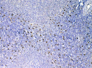Anti-IL33 Antibody