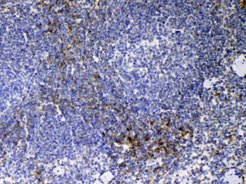 Anti-CD14 Antibody