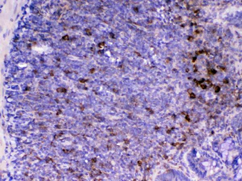 Anti-CD14 Antibody