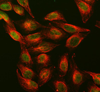 Anti-Dnmt1 Antibody