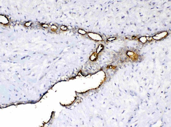 Anti-MUC1 Antibody