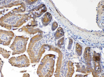 Anti-MUC1 Antibody