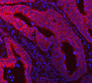 DDX58 Antibody
