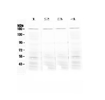 Angiotensin Converting Enzyme 1/Ace Antibody