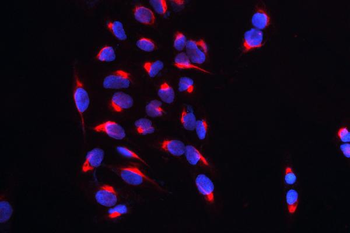 Anti-CARS Antibody