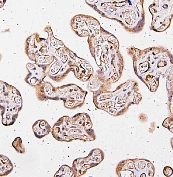 Anti-CARS Antibody