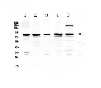 Anti-CARS Antibody