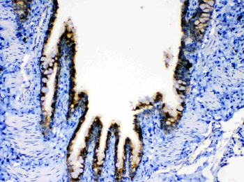 Anti-AGRP Antibody