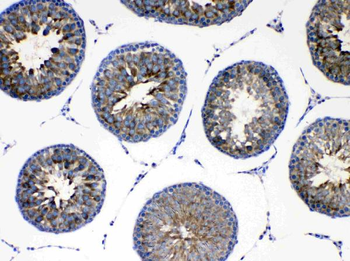 Anti-AGRP Antibody