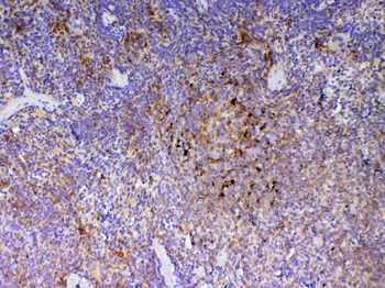 Anti-ICOS Antibody