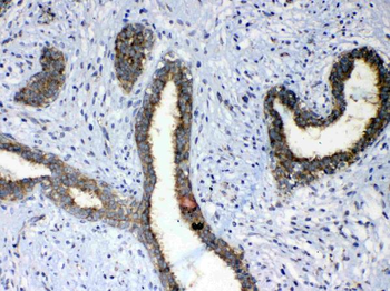 Anti-ErbB 4/ERBB4 Antibody