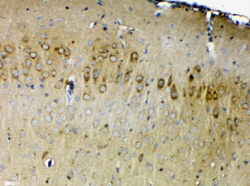 Anti-ErbB 4/ERBB4 Antibody
