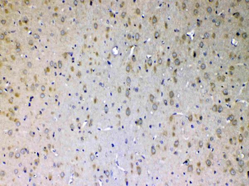 Anti-ErbB 4/ERBB4 Antibody