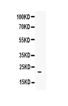 BMP4 Rabbit Polyclonal Antibody