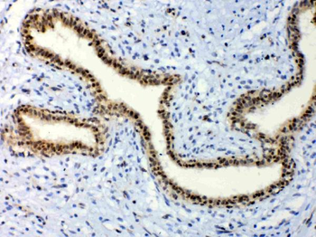 Anti-ETV6/Tel Antibody