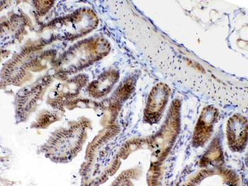 Anti-ETV6/Tel Antibody