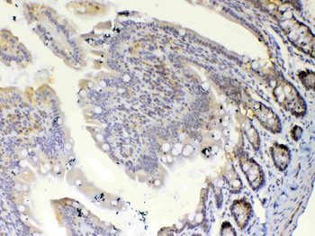 Anti-ETV6/Tel Antibody
