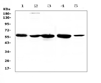 Anti-ETV6/Tel Antibody