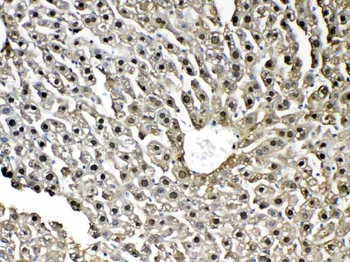 Anti-GST3/GST pi/Gstp1 Antibody