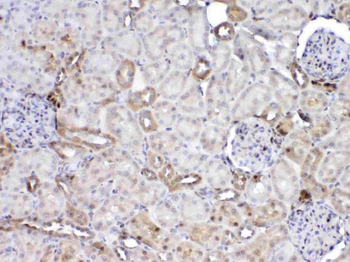 Anti-GST3/GST pi/Gstp1 Antibody
