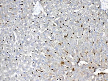 Anti-GST3/GST pi/Gstp1 Antibody