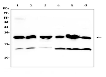 Anti-GST3/GST pi/Gstp1 Antibody