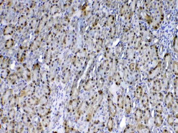 Anti-GST3/GST pi/Gstp1 Antibody