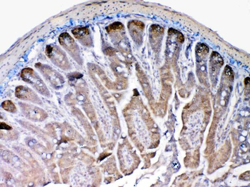 Anti-MMP13 Antibody