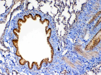 Anti-MMP13 Antibody