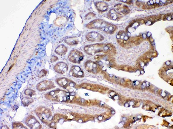 Anti-MMP13 Antibody