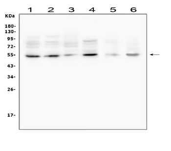 Anti-MMP13 Antibody