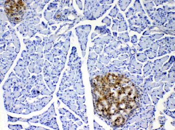 Anti-IL17/Il17a Antibody