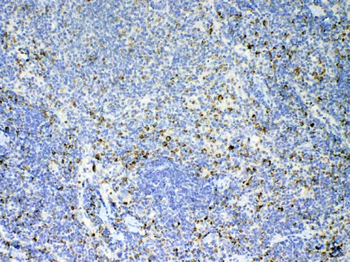 Anti-IL17/Il17a Antibody