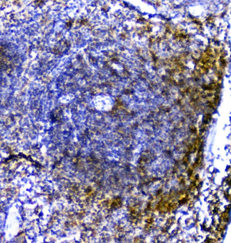 TRAIL/TNFSF10 Antibody