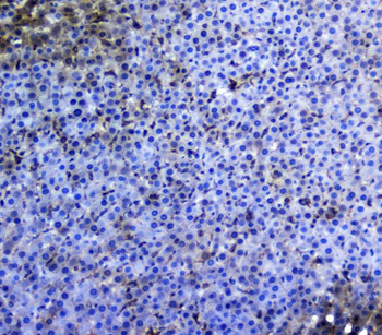 TRAIL/TNFSF10 Antibody