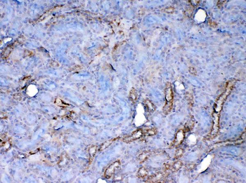 Anti-Galectin 1/Lgals1 Antibody