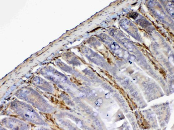 Anti-Galectin 1/Lgals1 Antibody