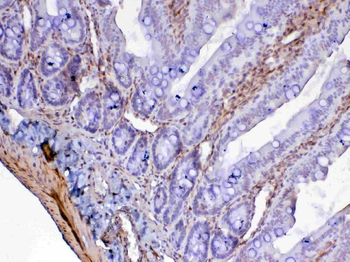 Anti-Galectin 1/Lgals1 Antibody