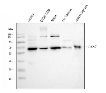 Anti-CD5 Antibody