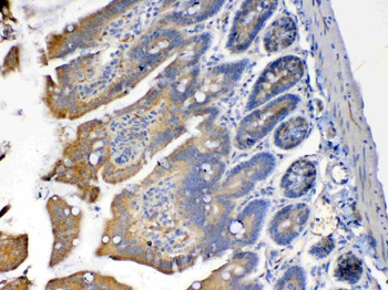 Anti-PON1 Antibody