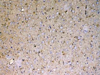 Anti-Sacsin Antibody