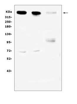 Anti-Sacsin Antibody