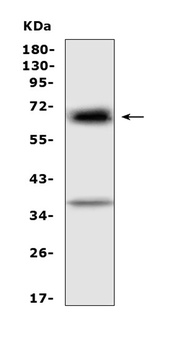 Alpha 1 Fetoprotein/Afp Antibody