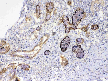 Anti-GALE Antibody