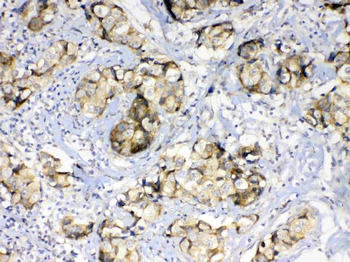 Anti-GALE Antibody
